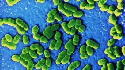 路南疾控·健康天地丨警惕身边的人畜共患传染病——布鲁氏菌病